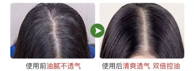 和螨虫说拜拜!持续断货的澳洲茶树洗护系列全新升级!抢先体验(图28)