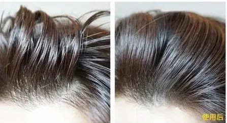 亚麻籽究竟有多神奇?用它,头发蓬松不出油,关键是拯救秃头!(图5)