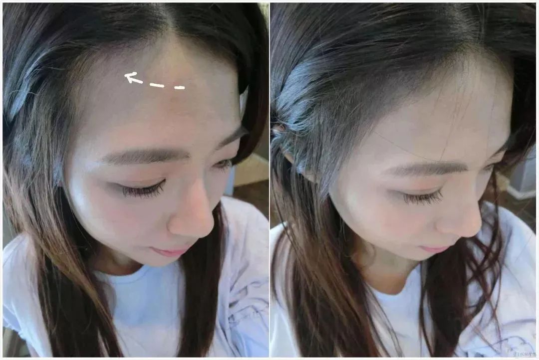 亚麻籽究竟有多神奇?用它,头发蓬松不出油,关键是拯救秃头!(图6)