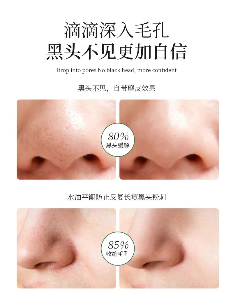 祛黑头套盒_08.jpg 图片