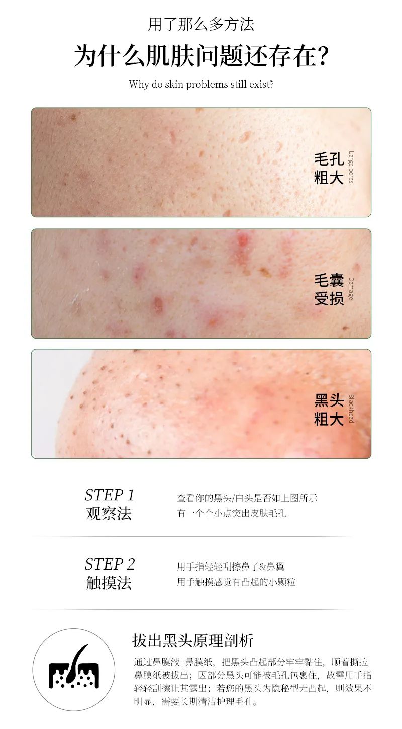 祛黑头套盒_02.jpg 图片