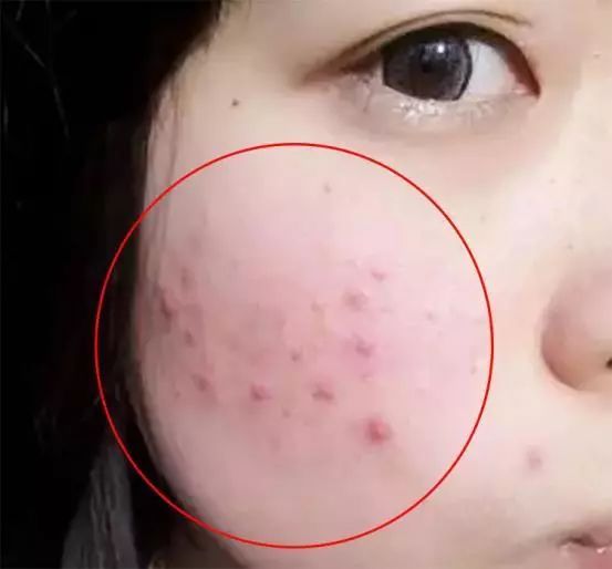 听说皮肤有螨虫?别怕,性价比巨高的神仙洗面奶,带你创造牛奶嫩肌!(图4) 图片