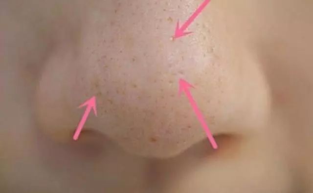 听说皮肤有螨虫?别怕,性价比巨高的神仙洗面奶,带你创造牛奶嫩肌!(图2) 图片