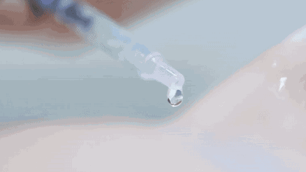 油田脸秒变水光肌!粉刺痘痘跑光光!植树澳洲茶树纯露瞬时补水,告别草莓鼻。(图8) 图片