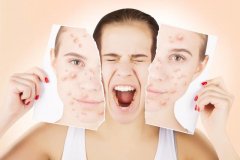 大澳化妆品：脸上经常长粉刺是什么原因？